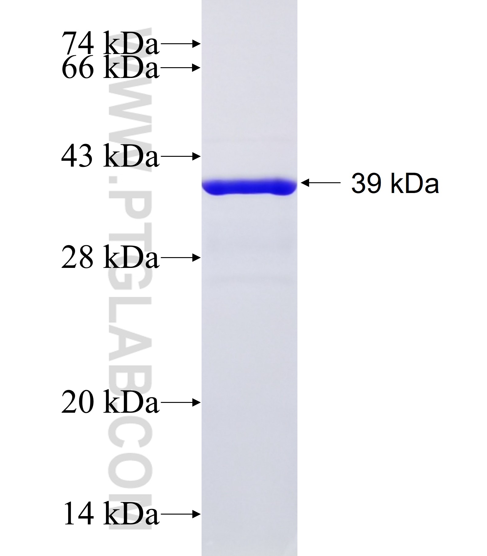 ZDHHC15 fusion protein Ag16152 SDS-PAGE