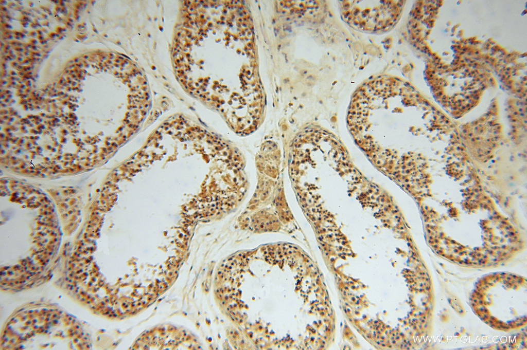 IHC staining of human testis using 15465-1-AP