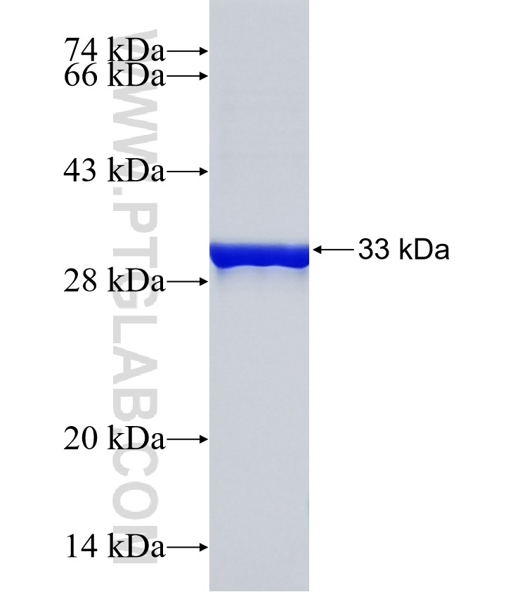 ZDHHC2 fusion protein Ag20158 SDS-PAGE