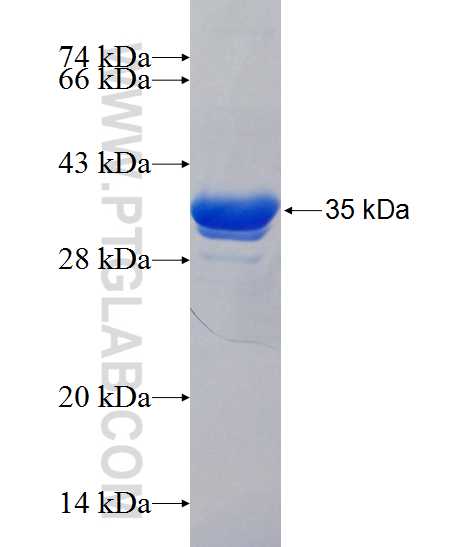 ZDHHC23 fusion protein Ag24570 SDS-PAGE ZDHHC23 fusion protein Ag24570 SDS-PAGE
