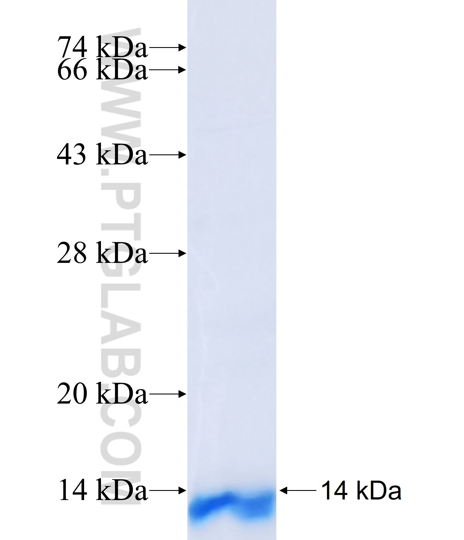 ZDHHC3 fusion protein Ag39872 SDS-PAGE ZDHHC3 fusion protein Ag39872 SDS-PAGE