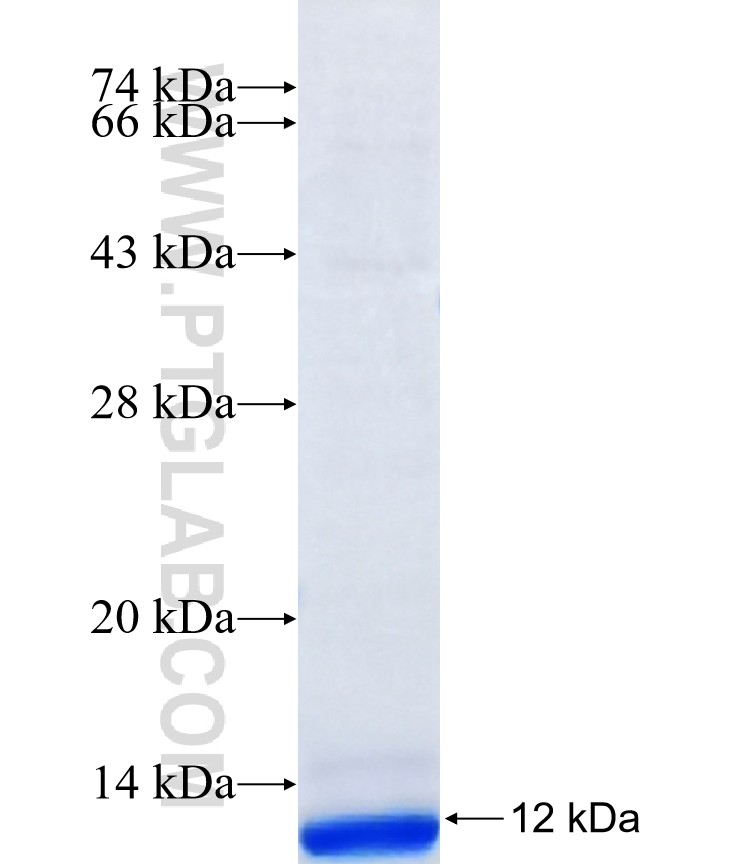 ZDHHC4 fusion protein Ag39979 SDS-PAGE