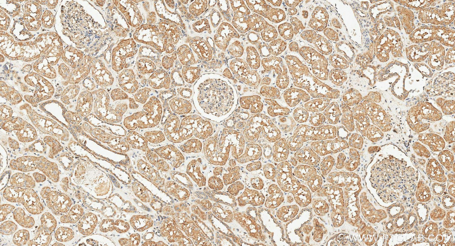 IHC staining of human kidney using 21324-1-AP IHC staining of human kidney using 21324-1-AP