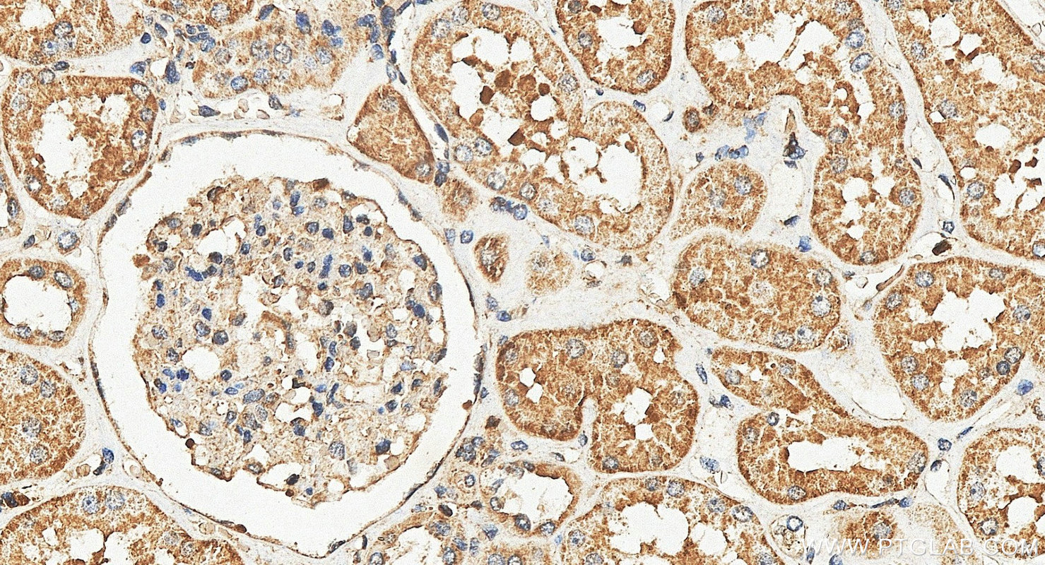 IHC staining of human kidney using 21324-1-AP IHC staining of human kidney using 21324-1-AP