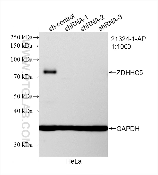 WB analysis of HeLa using 21324-1-AP