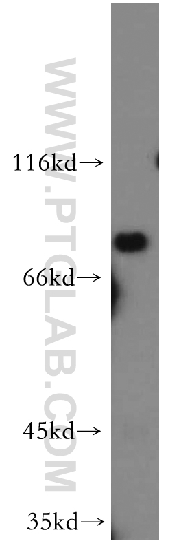 WB analysis of mouse kidney using 21324-1-AP