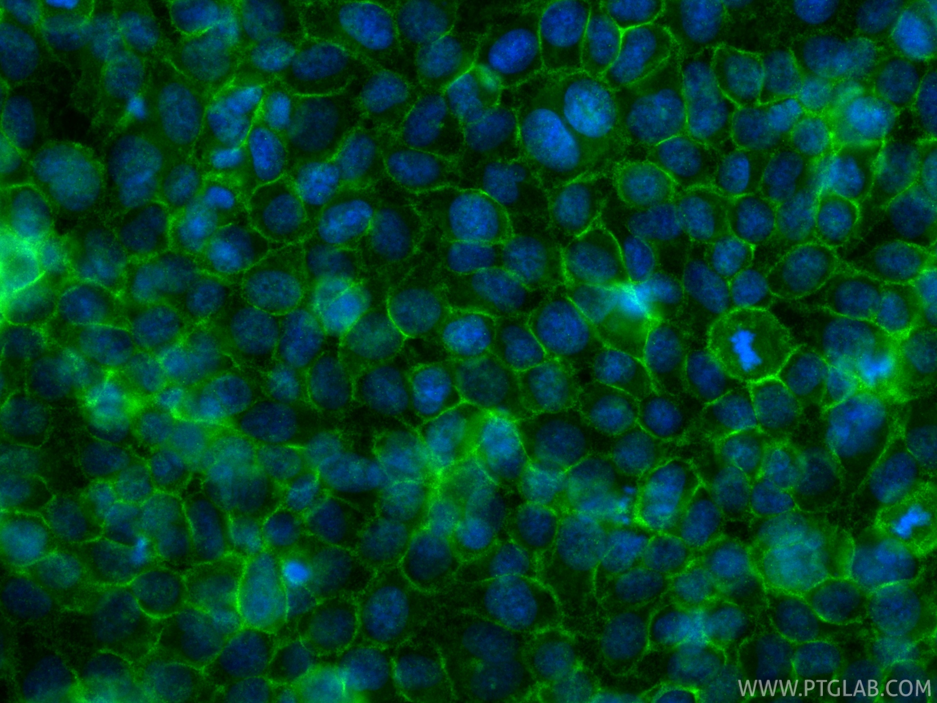 IF Staining of HeLa using 84803-4-RR IF Staining of HeLa using 84803-4-RR