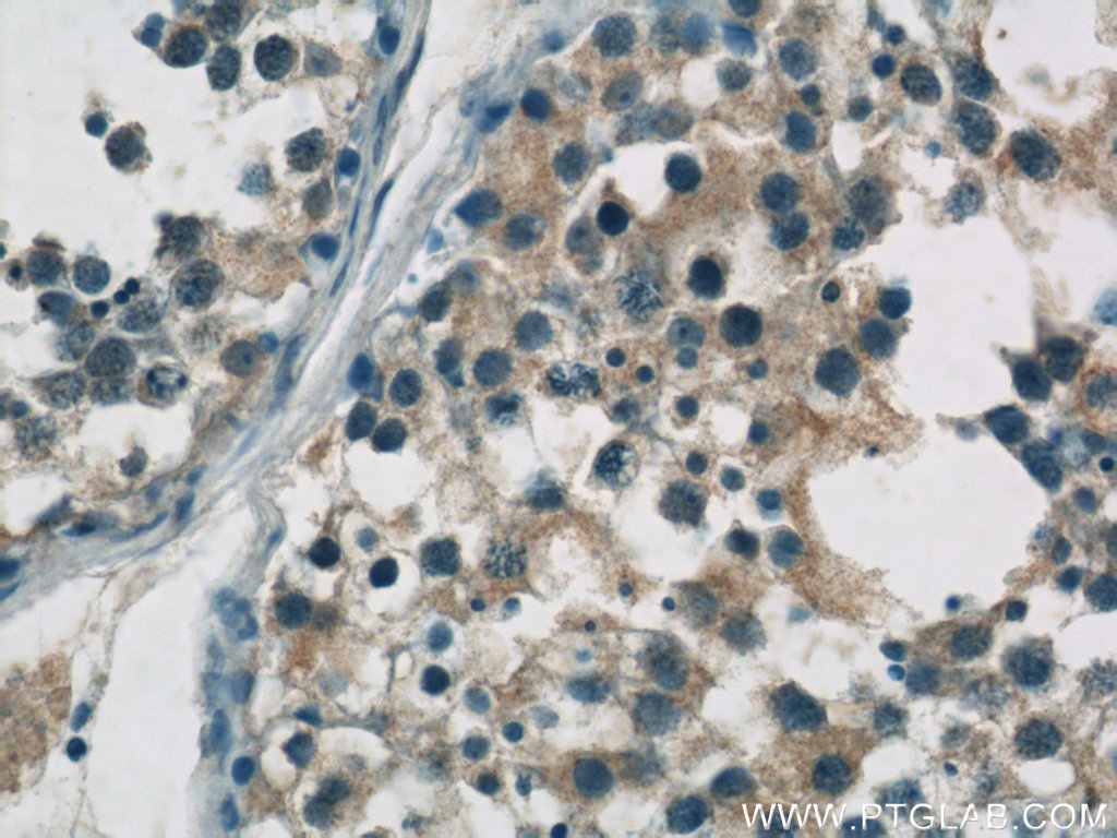 IHC staining of human testis using 24046-1-AP