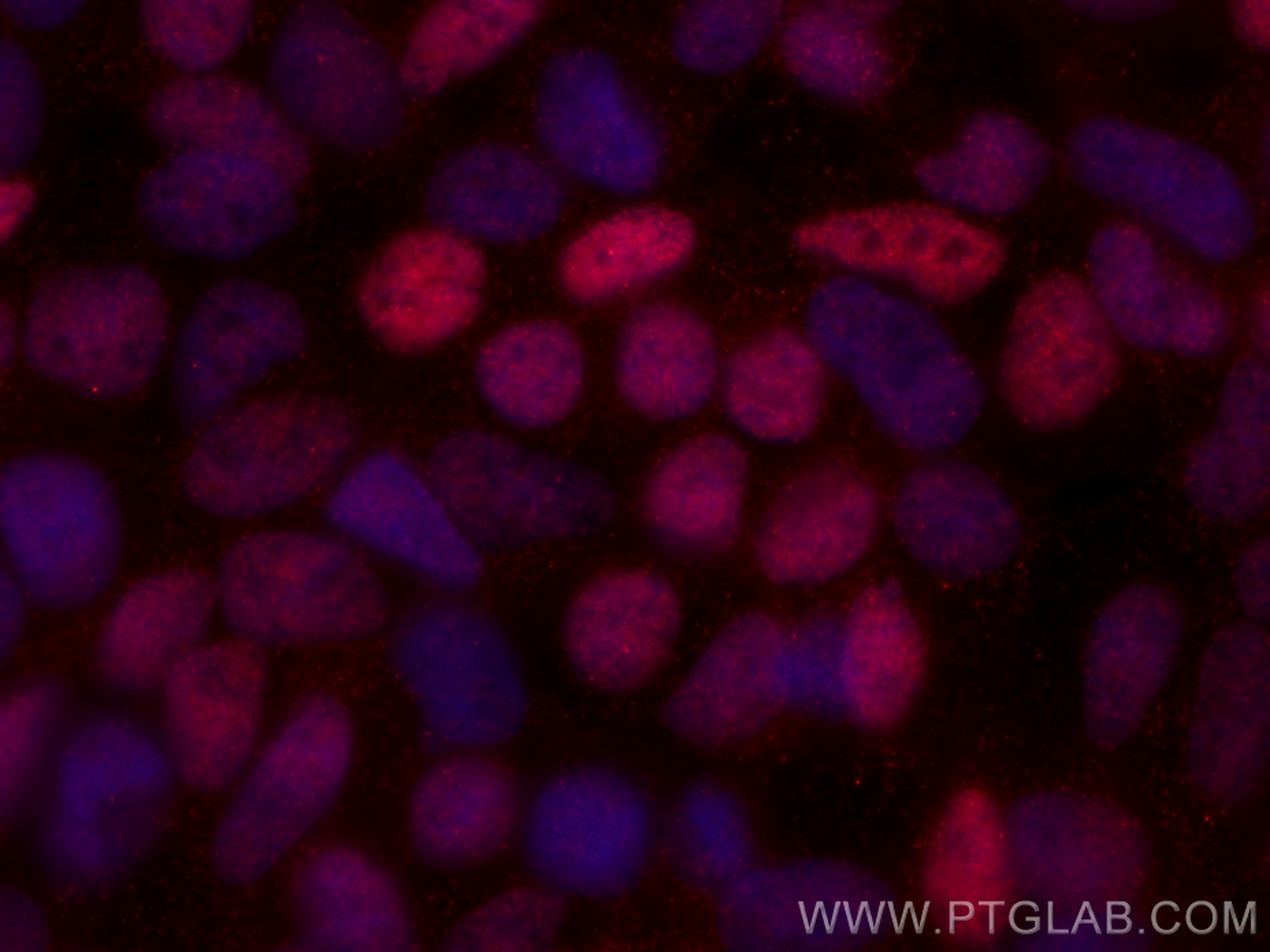 IF Staining of HEK-293 using CL594-66279