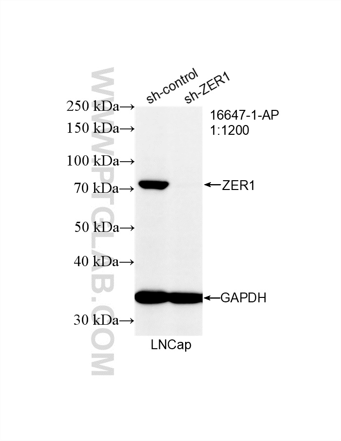 WB result of ZER1 antibody (16647-1-AP; 1:1200; incubated at room temperature for 1.5 hours) with sh-Control and sh-ZER1 transfected LNCaP cells. WB analysis of LNCaP using 16647-1-AP