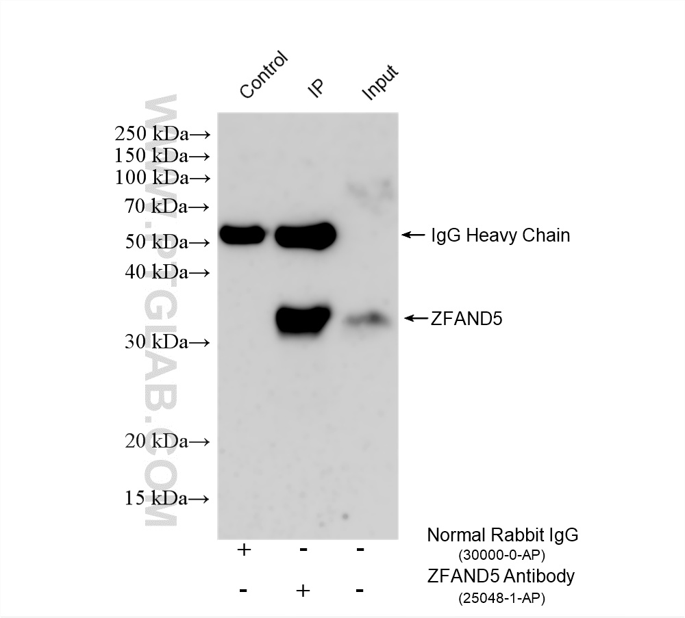 IP experiment of mouse brain using 25048-1-AP (same clone as 25048-1-PBS) IP experiment of mouse brain using 25048-1-AP (same clone as 25048-1-PBS)