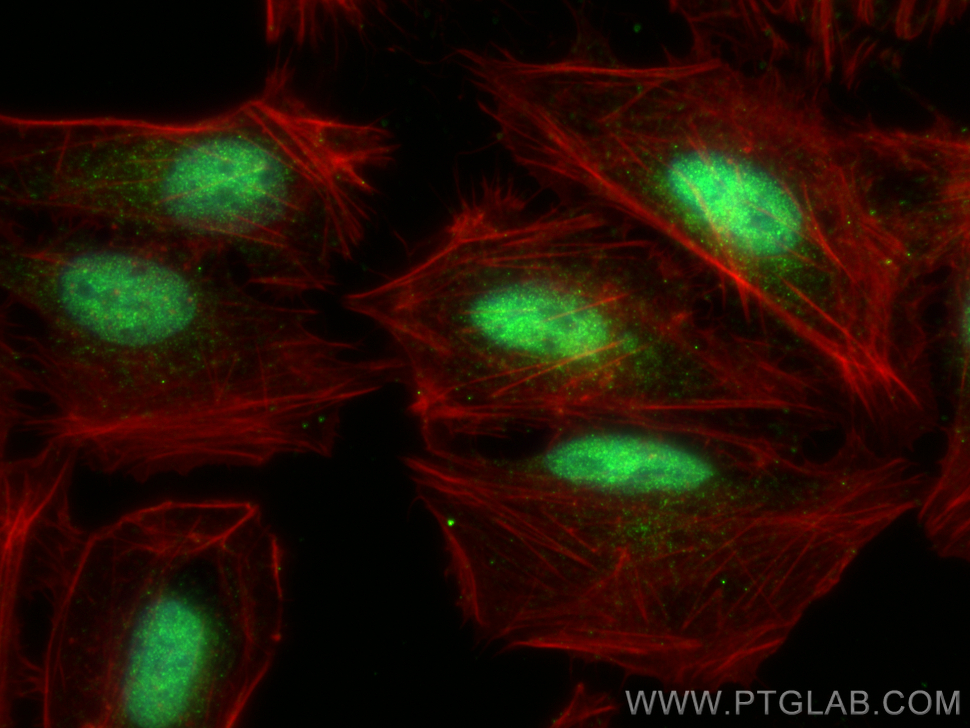Immunofluorescent analysis of (4% PFA) fixed U2OS cells using ZFC3H1 antibody (30834-1-AP) at dilution of 1:400 and CoraLite®488-Conjugated Goat Anti-Rabbit IgG(H+L) (<a class='green' href='/productredirect?CatalogNo=SA00013-2' target='_blank'>SA00013-2</a>), CL594-Phalloidin (red). IF Staining of U2OS using 30834-1-AP