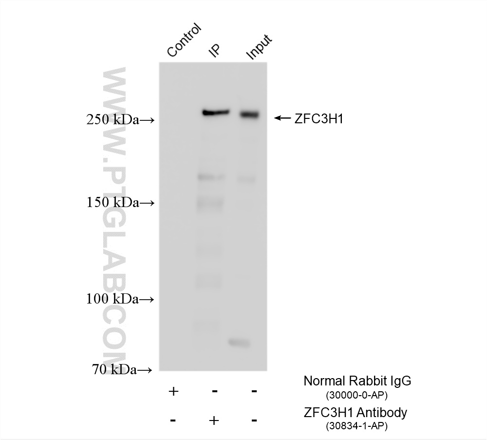 IP result of anti-ZFC3H1 (IP:30834-1-AP, 4ug; Detection:30834-1-AP 1:400) with DU 145 cells lysate 1360 ug. IP experiment of DU 145 using 30834-1-AP