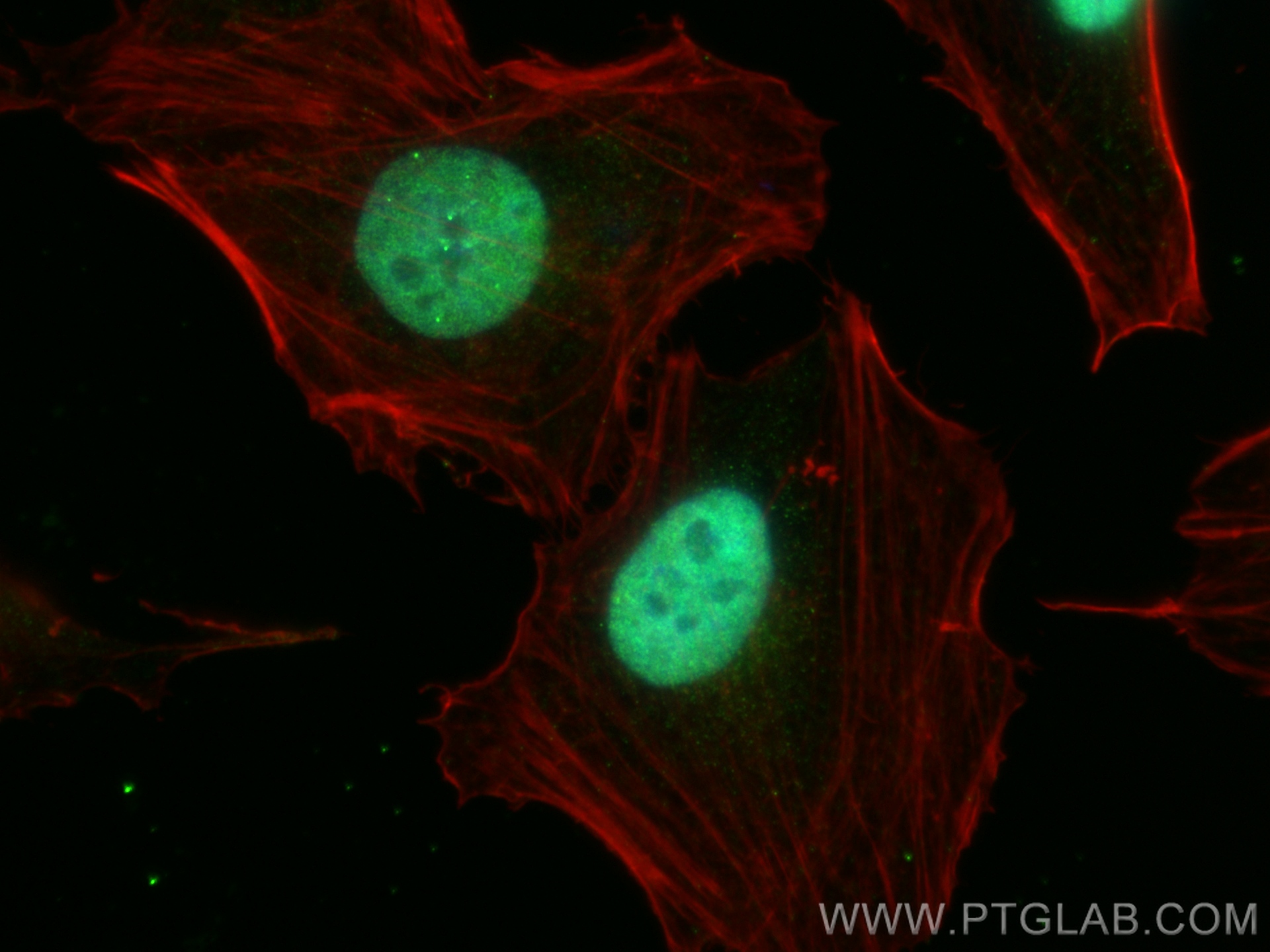 IF Staining of HeLa using 20157-1-AP