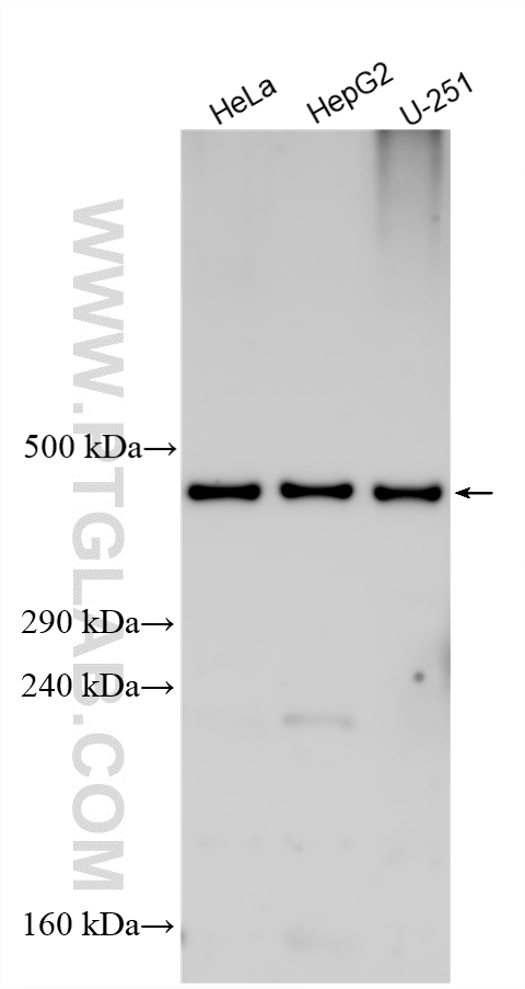 WB analysis using 31404-1-AP