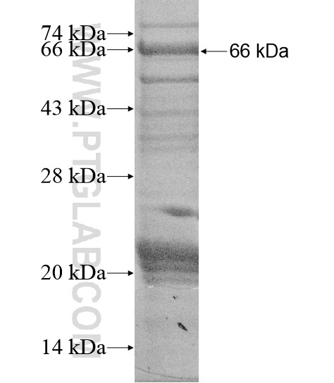ZFP112 fusion protein Ag20109 SDS-PAGE ZFP112 fusion protein Ag20109 SDS-PAGE