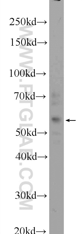 WB analysis of HepG2 using 24720-1-AP