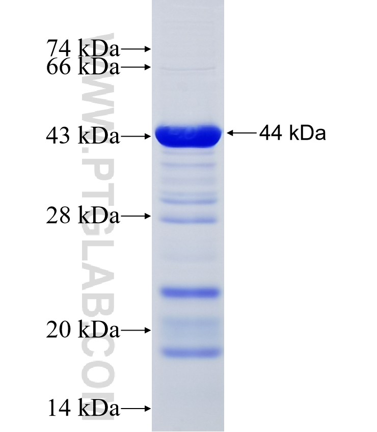 ZFP28 fusion protein Ag11545 SDS-PAGE ZFP28 fusion protein Ag11545 SDS-PAGE