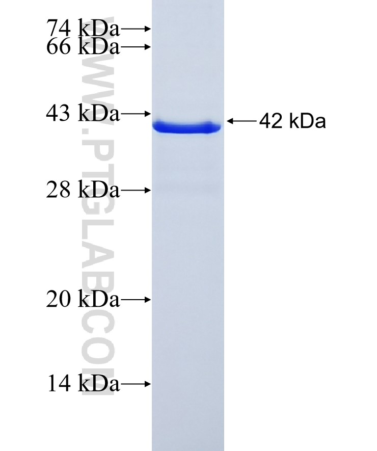 ZFP36 fusion protein Ag28473 SDS-PAGE