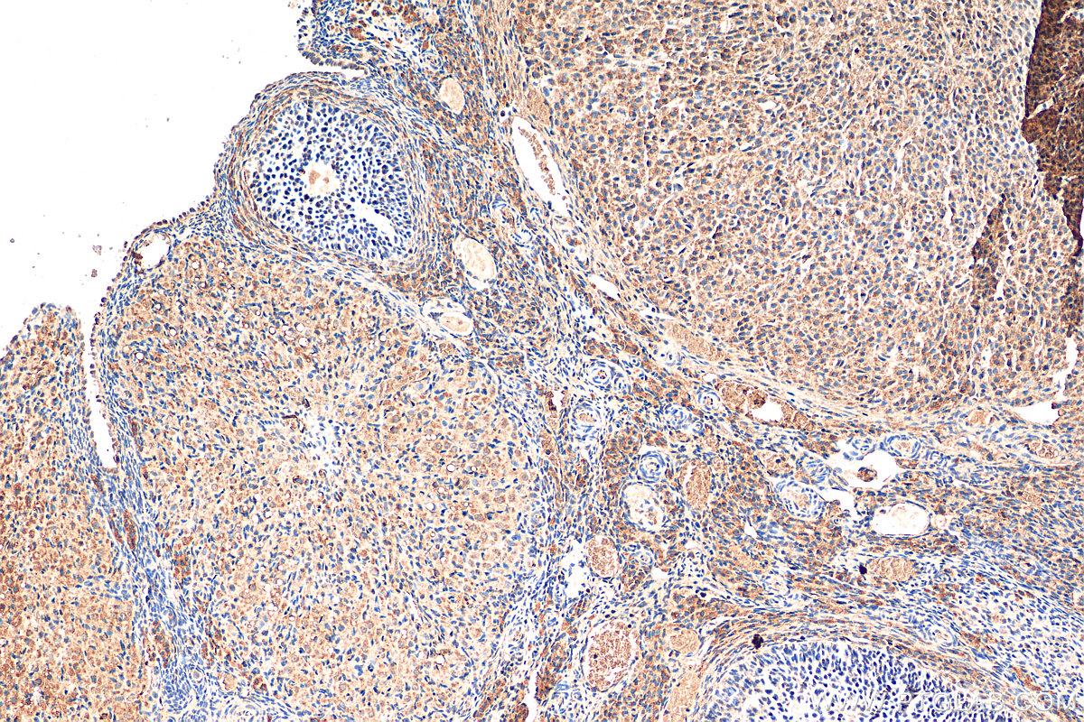 IHC staining of rat ovary using 12306-1-AP