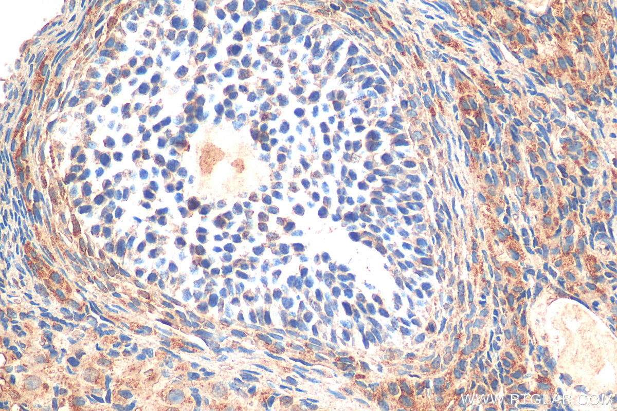 IHC staining of rat ovary using 12306-1-AP