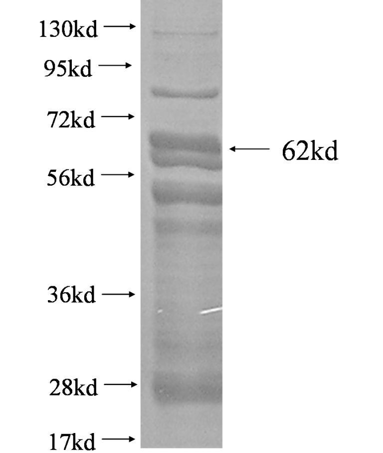 ZFP36L1 fusion protein Ag2952 SDS-PAGE