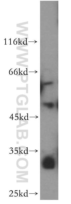 ZFP36L2