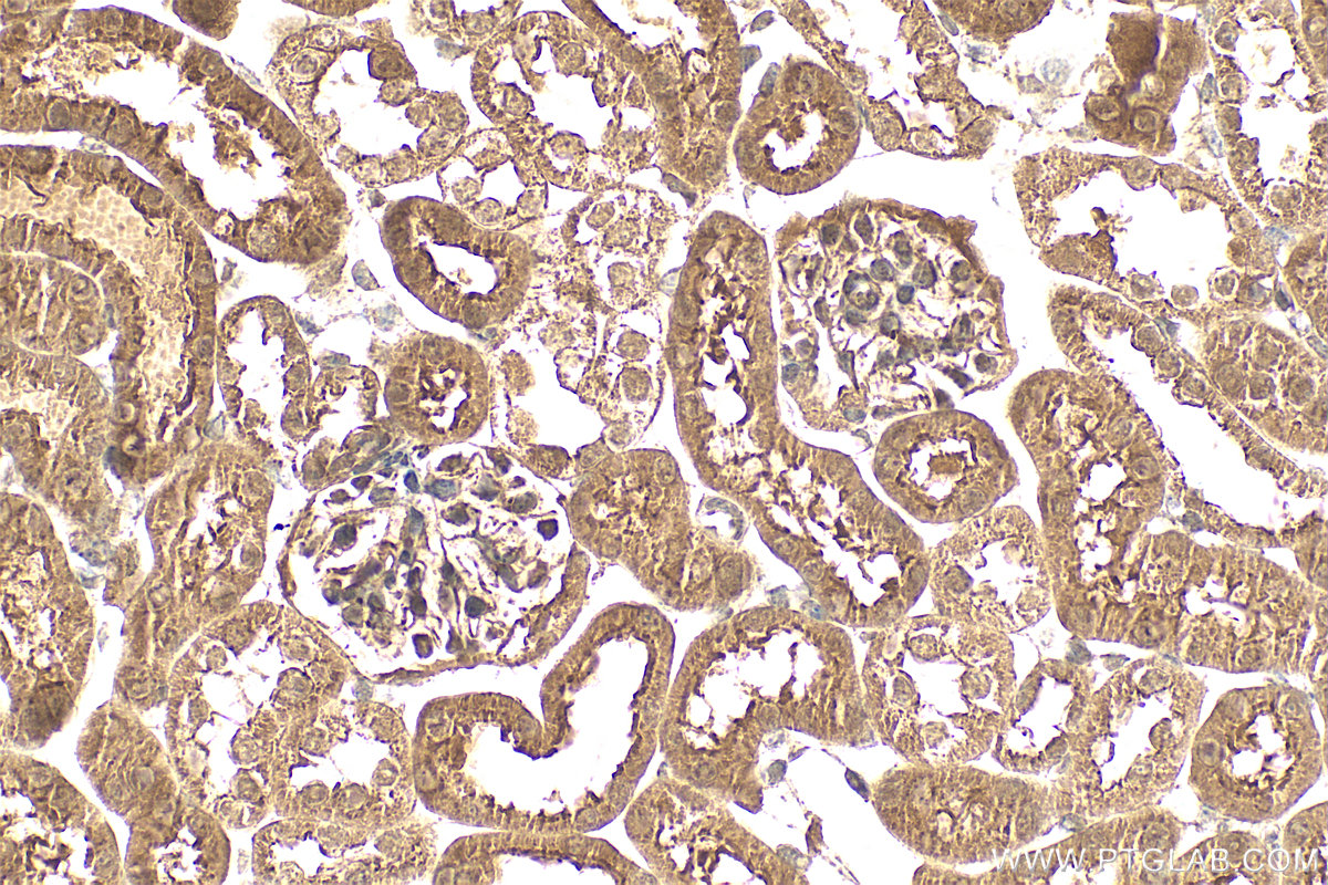 IHC staining of mouse kidney using 30640-1-AP
