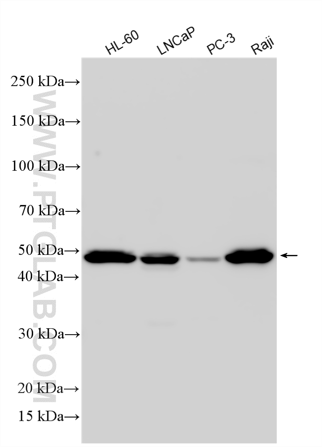 WB analysis using 31790-1-AP WB analysis using 31790-1-AP