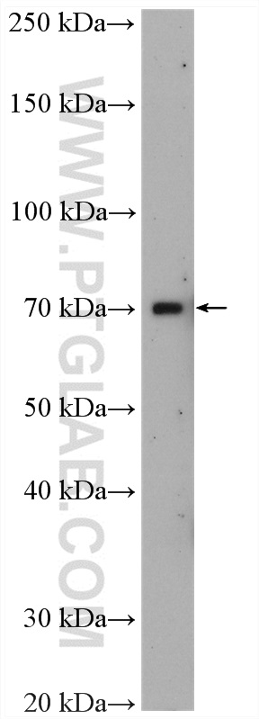 WB analysis of mouse spleen using 17187-1-AP