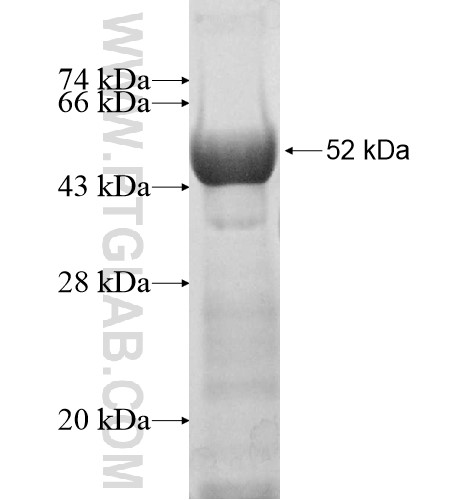 ZFP64 fusion protein Ag11251 SDS-PAGE ZFP64 fusion protein Ag11251 SDS-PAGE