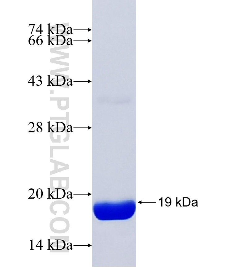 ZFPM2 fusion protein Ag38366 SDS-PAGE ZFPM2 fusion protein Ag38366 SDS-PAGE