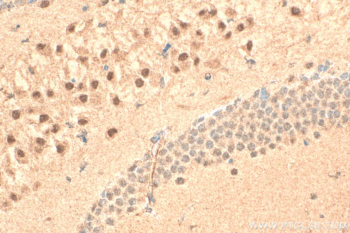 IHC staining of mouse brain using 23174-1-AP