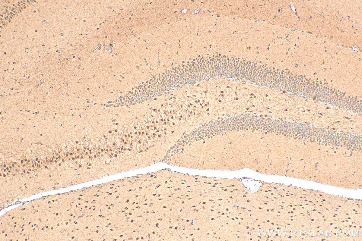IHC staining of mouse brain using 23174-1-AP