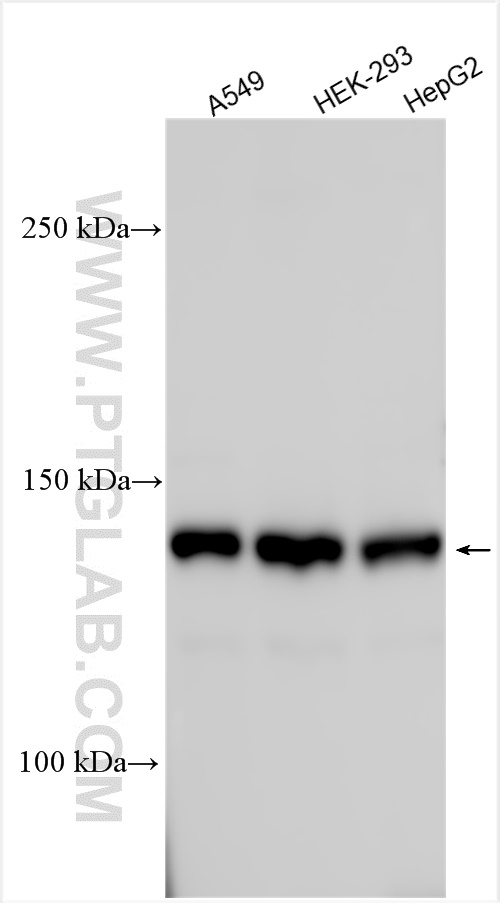 WB analysis using 23174-1-AP