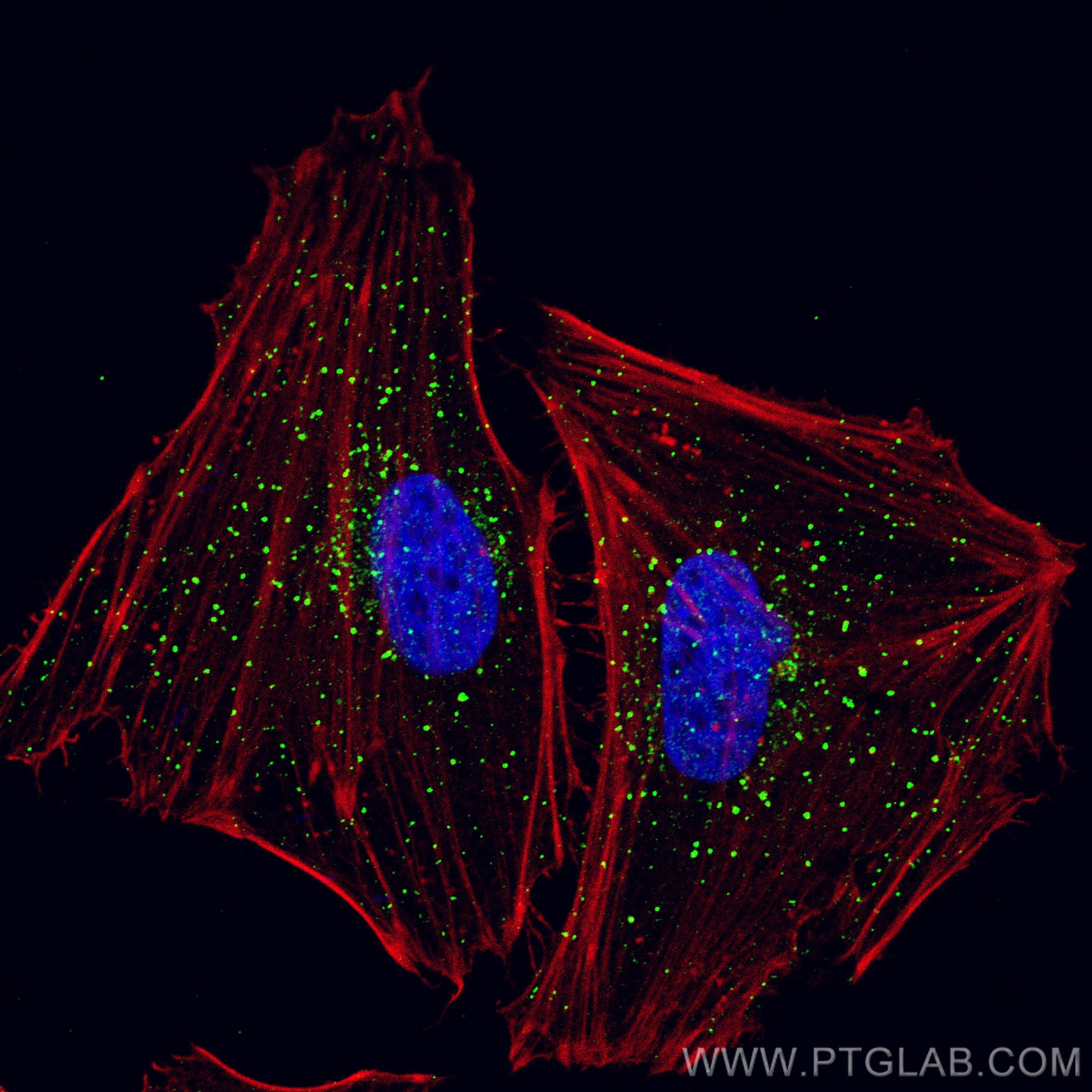 IF Staining of HeLa using 13118-2-AP