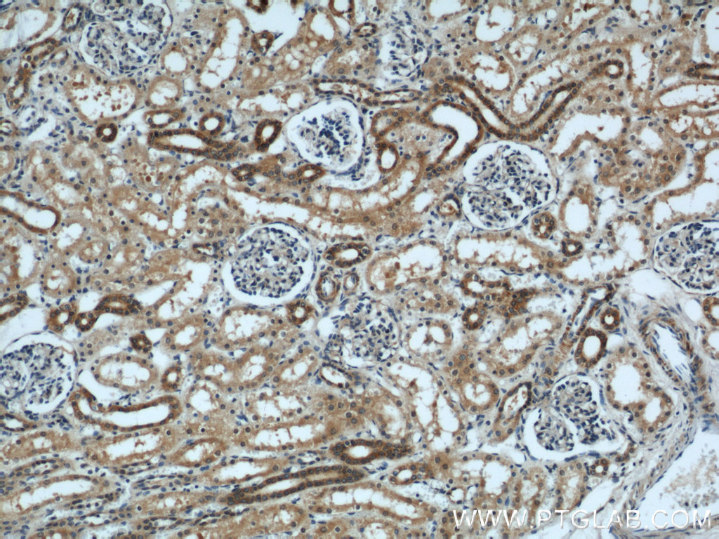 IHC staining of human kidney using 13118-2-AP