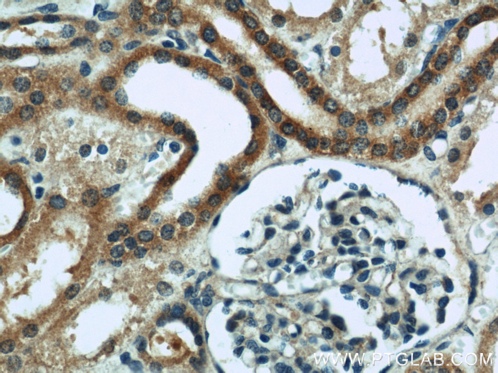 IHC staining of human kidney using 13118-2-AP