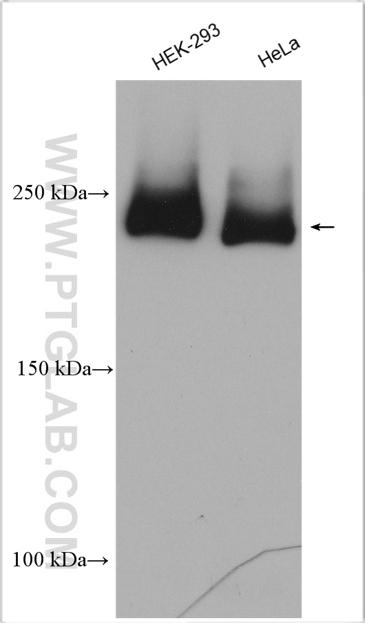 WB analysis using 13118-2-AP