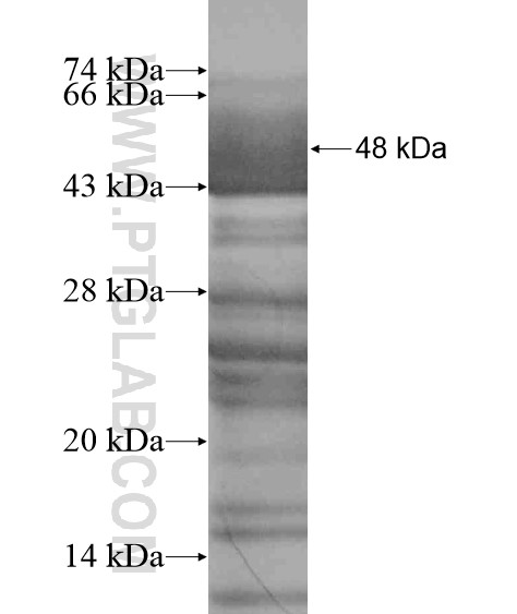 ZFYVE19 fusion protein Ag19627 SDS-PAGE ZFYVE19 fusion protein Ag19627 SDS-PAGE