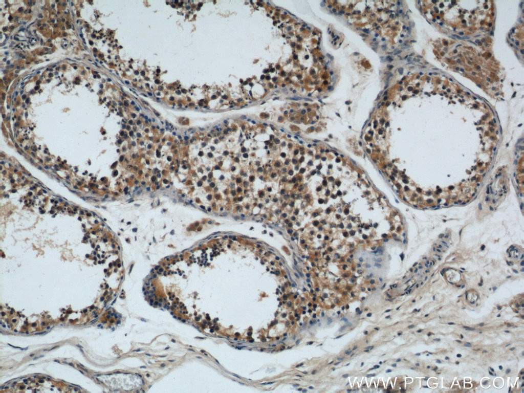 IHC staining of human testis using 22218-1-AP