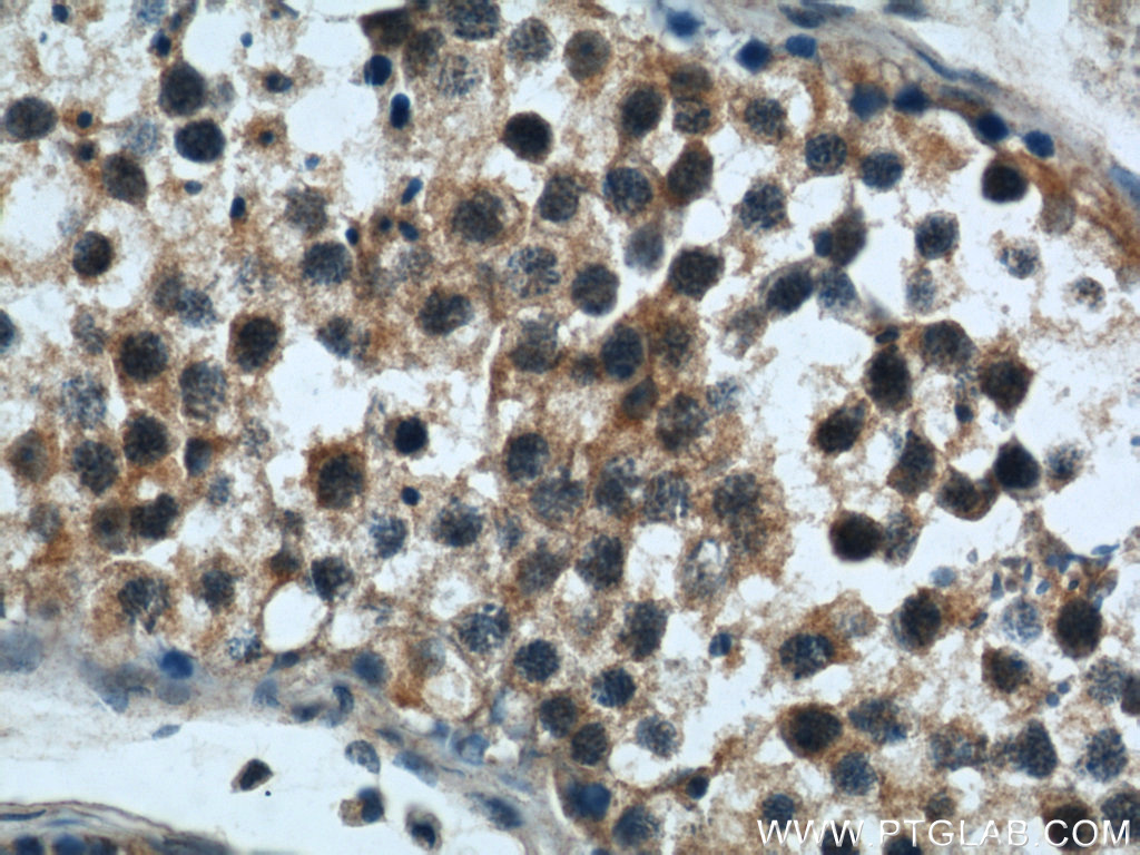 IHC staining of human testis using 22218-1-AP