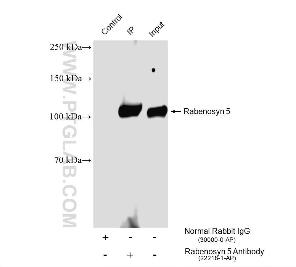 IP experiment of mouse heart using 22218-1-AP IP experiment of mouse heart using 22218-1-AP