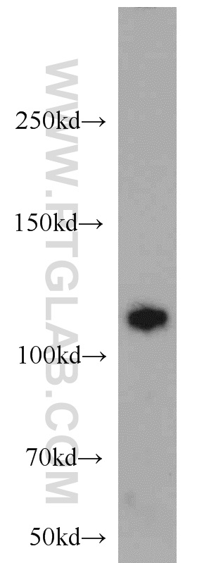 WB analysis of K-562 using 22218-1-AP