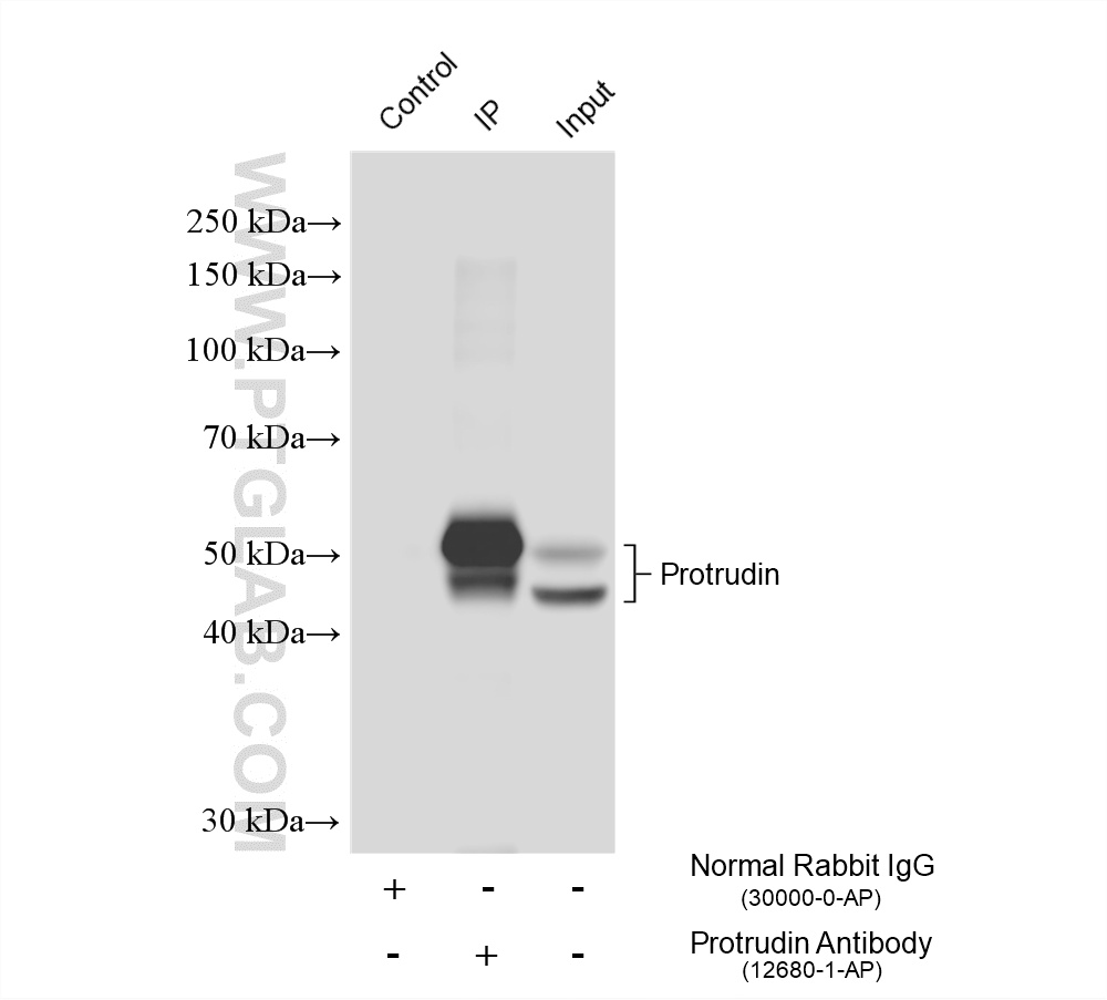 IP experiment of mouse brain using 12680-1-AP IP experiment of mouse brain using 12680-1-AP