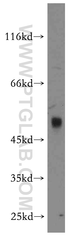 WB analysis of mouse thymus using 12680-1-AP