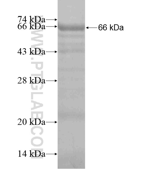 ZFYVE28 fusion protein Ag19638 SDS-PAGE