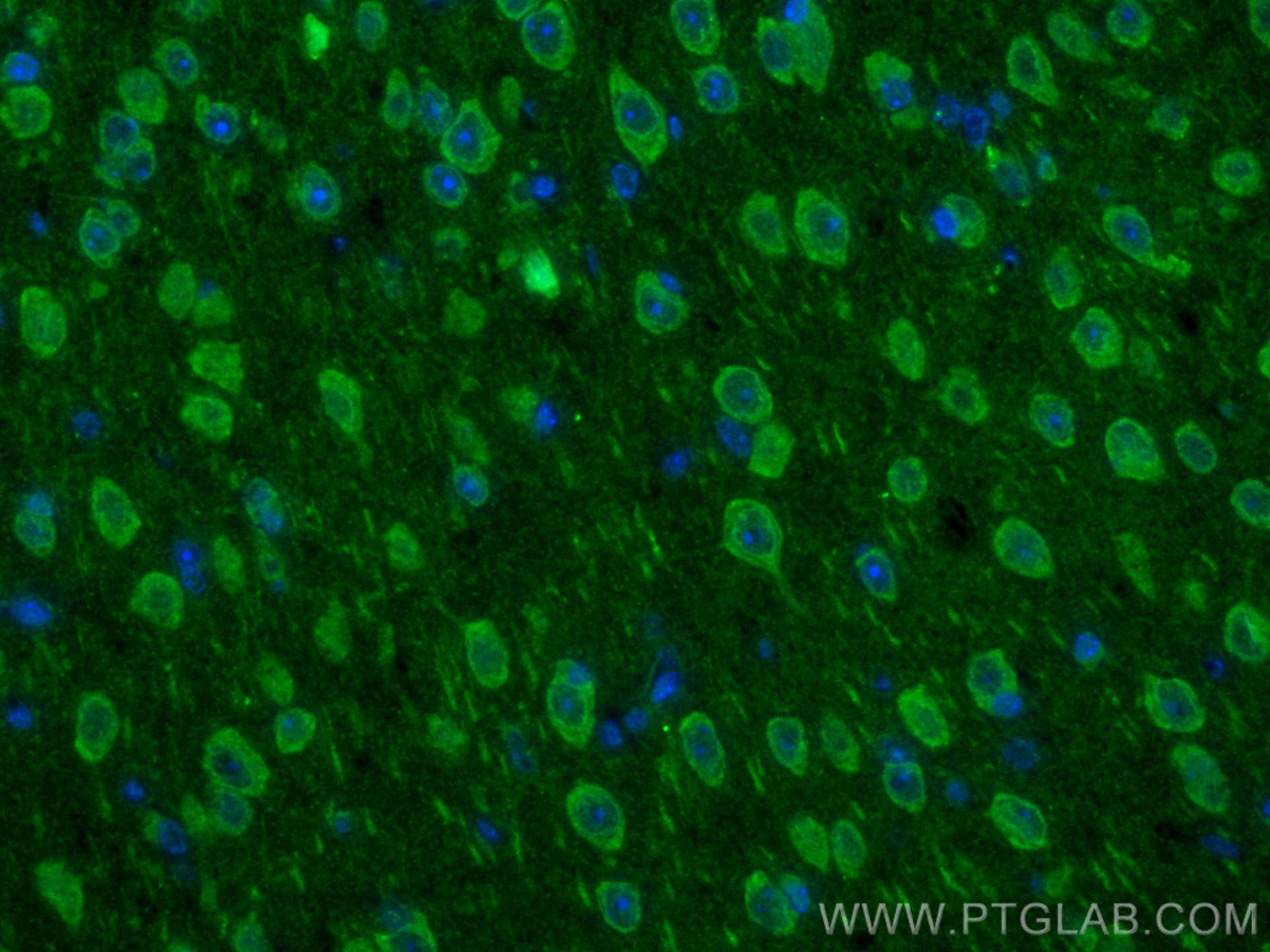IF Staining of mouse brain using 22033-1-AP