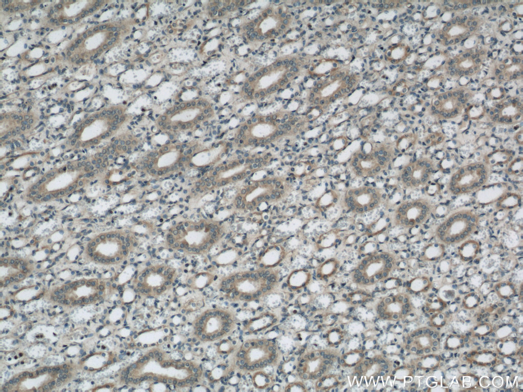 IHC staining of human kidney using 22033-1-AP