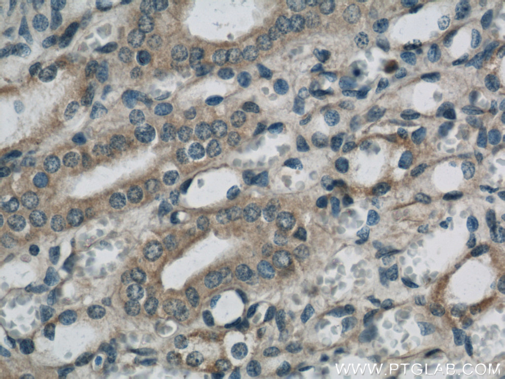 IHC staining of human kidney using 22033-1-AP